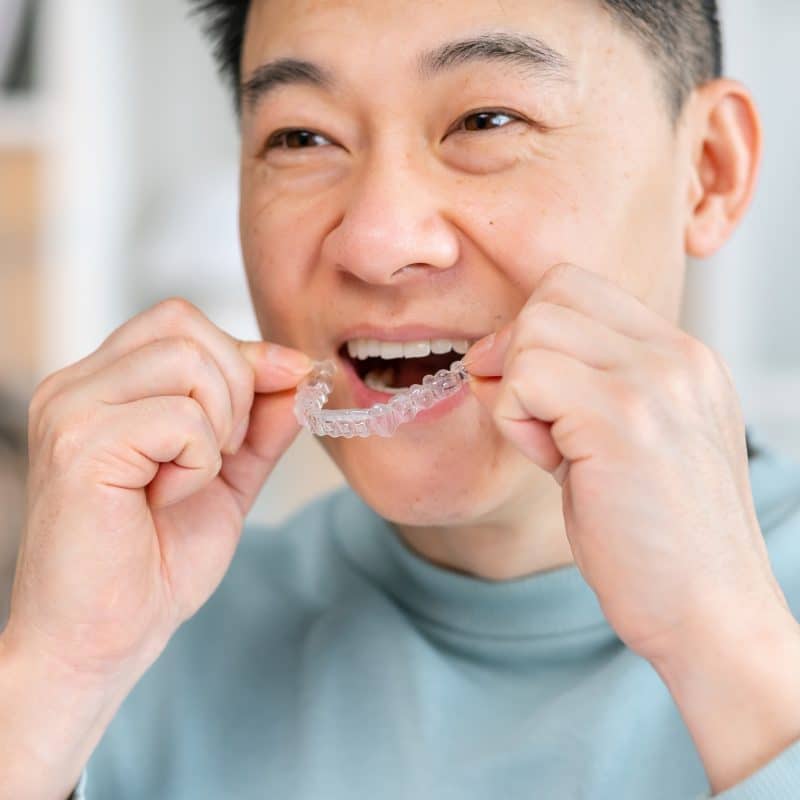 older man putting in his clear aligners